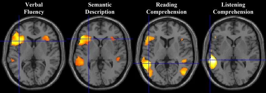 fMRI scans for different tasks - Feasibility, Contrast Sensitivity and Network Specificity of Language fMRI in Presurgical Evaluation for Epilepsy and Brain Tumor Surgery